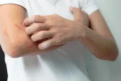 Chỉ định chụp thận thuốc tĩnh mạch liều cao