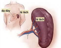 Phình động mạch trong động mạch lách: Những điều cần biết
