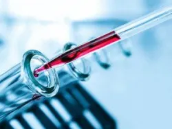 Omega-3 liệu có cần thiết trong việc ngăn ngừa, làm chậm bệnh Alzheimer?