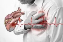 Điện châm điều trị hội chứng vai gáy