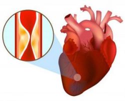 Nguyên nhân nhiễm toan ceton ở người bệnh đái tháo đường