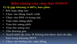 Ép tim cấp là gì? Các dấu hiệu nhận biết và điều trị
