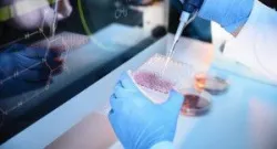 Chữ ký Gene miễn dịch - Công cụ mới cho liệu pháp điều trị ung thư