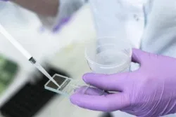 Xét nghiệm phân mảnh DNA tinh trùng trong chẩn đoán hiếm muộn