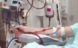 Yếu tố ảnh hưởng tới quả lọc trong điều trị thay thế thận liên tục