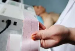 Vì sao rung nhĩ gây nguy cơ đột quỵ?