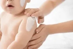 Hướng dẫn chăm sóc da ở bệnh nhân viêm da cơ địa
