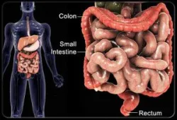 Bệnh nhân viêm ruột (IBD) cần làm gì khi bị căng thẳng?