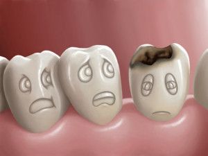 Thiếu canxi ảnh hưởng như thế nào đến răng?