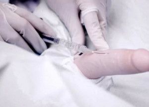 Tiêm Filler Làm To Dương Vật