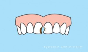 Ảnh hưởng của bệnh tiểu đường type 2 đến sức khỏe răng miệng