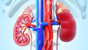 Hội chứng Fanconi là gì?