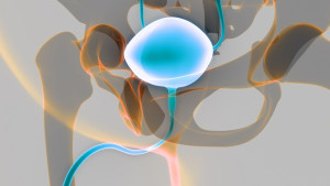 Ung thư niệu đạo: Triệu chứng và cách điều trị