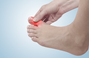 Thoái hóa khớp bàn ngón chân cái: Triệu chứng và cách điều trị