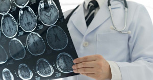 Làm thế nào để tầm soát đột quỵ?