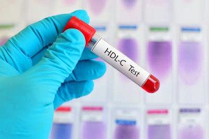 HDL cholesterol quá cao có gây hại không?
