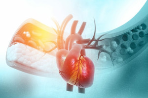 Căng thẳng kéo dài có thể gây tăng cholesterol máu