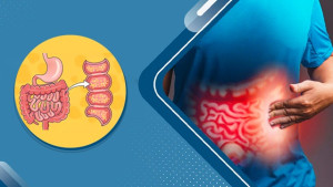 Bệnh Crohn: Triệu chứng và phương pháp điều trị