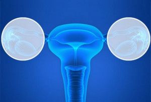 Khi nào cần phẫu thuật cắt buồng trứng - ống dẫn trứng?