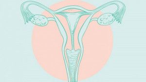 Nhận biết dấu hiệu sớm của ung thư buồng trứng