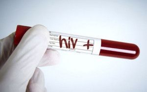Thời kỳ cửa sổ của HIV là gì?