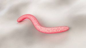 U hạt bẹn: Căn bệnh “ăn thịt người” lây qua đường tình dục