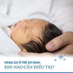 Một Vài Tác Dụng Phụ Của Chiếu Đèn Vàng Da Sơ Sinh