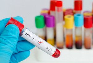 Bao lâu sau khi quan hệ không dùng bao cao su thì có thể xét nghiệm HIV?