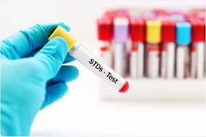 11 điều cần biết về xét nghiệm STD
