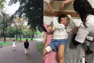 Bé trai 3 tuổi nhập viện điều trị sau khi bị chó lạ tấn công tại Công viên Yên Sở