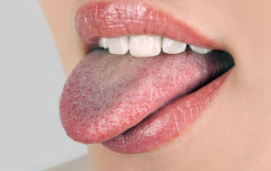 Màu lưỡi nói lên tình trạng sức khỏe của bạn