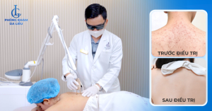 Review điều trị viêm lỗ chân lông tại Phòng khám Da liễu LG: Hiệu quả và chi phí mới nhất