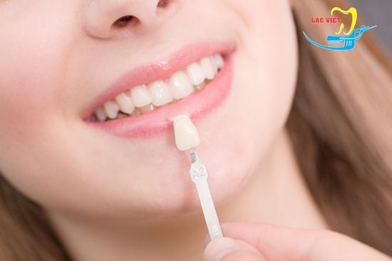 Bọc răng sứ chữa móm nhẹ