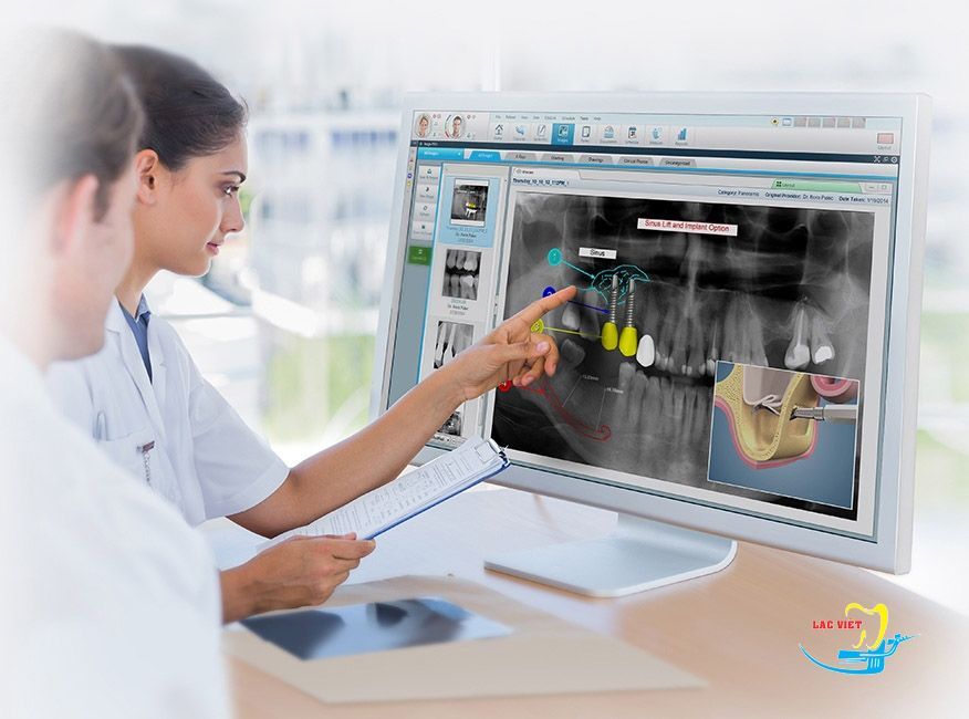 Phân tích độ dày của xương hàm trước khi phục hình trồng răng implant