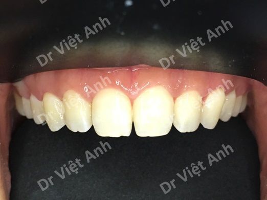 nieng rang 10 thang 4