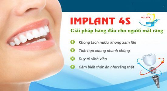 Công nghệ implant 4S giúp phục hình răng hoàn hảo không đau nhức