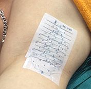  Vẽ sơ đồ tuyến mồ hôi vùng nách. 