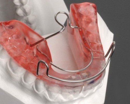 Cách bảo quản hàm duy trì