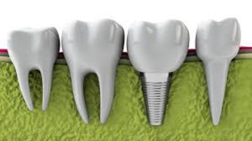 Chăm sóc miệng và những điều nên biếtChăm sóc miệng và những điều nên biết