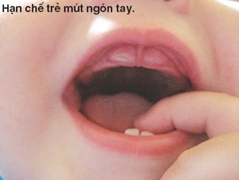 Cách xử lý khi bé chậm mọc răng
