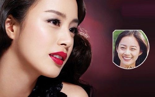 Kim Tae Hee lột xác nhờ niềng răng