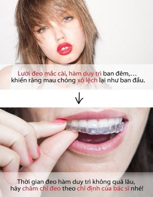 Cách bảo quản hàm duy trì