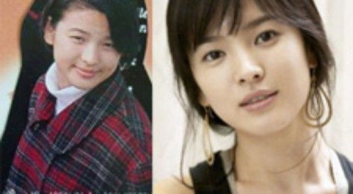 Những mỹ nhân Hàn từng thẩm mỹ răng miệng