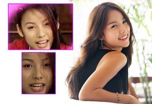 Những mỹ nhân Hàn từng thẩm mỹ răng miệng