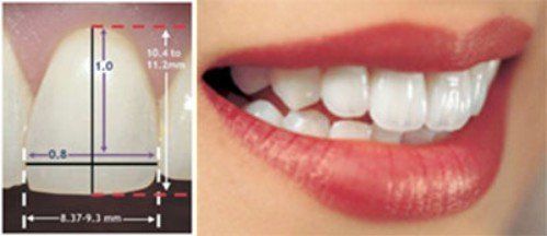 Răng đẹp cần đạt những tiêu chuẩn nào