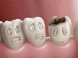 Sâu răng ở trẻ em và cách phòng ngừa - Nha khoa Đăng Lưu