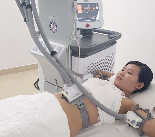 Giảm mỡ Sculpsure giá bao nhiêu tiền