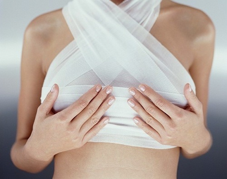 Tác dụng của áo lót định hình sau phẫu thuật nâng ngực - Bs Nguyễn Thanh Vân