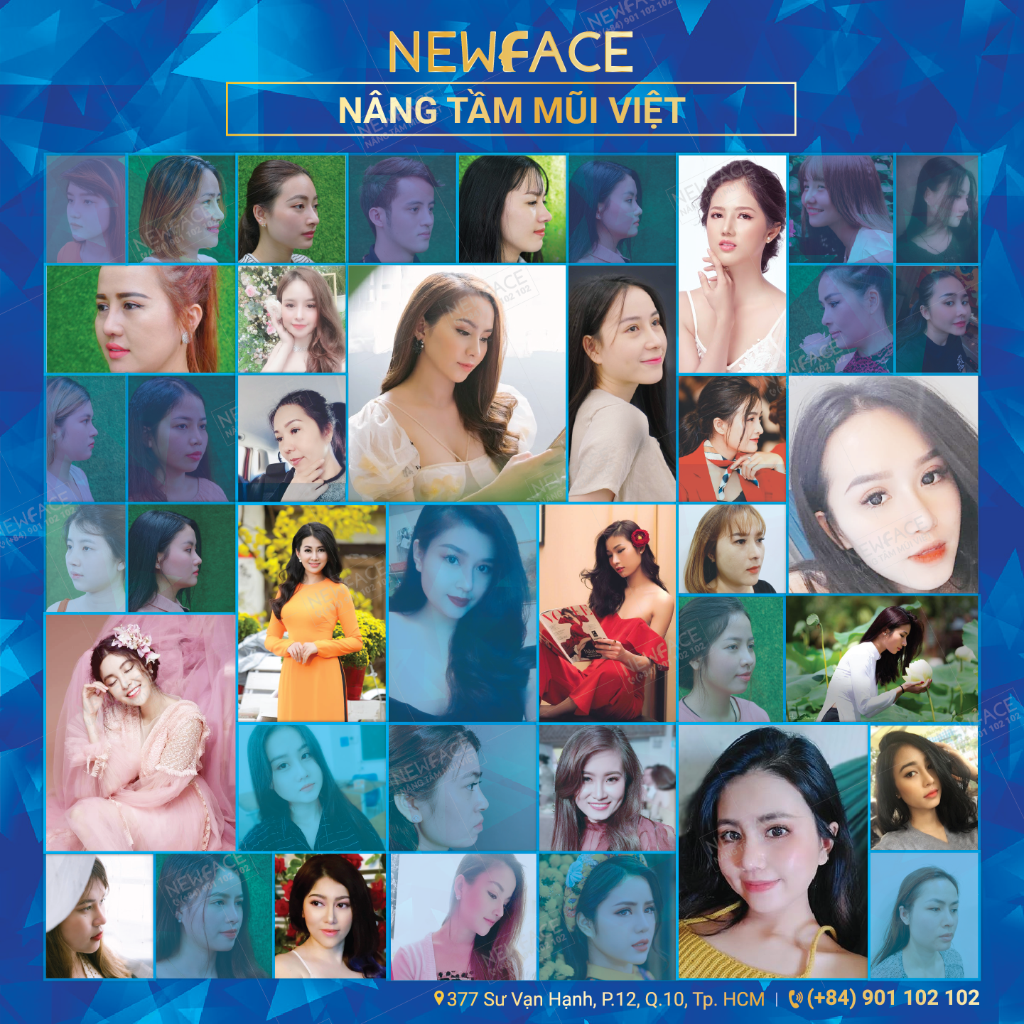 Vì sao nhiều Việt kiều từ Hàn Quốc về Việt Nam chọn nâng mũi tại Thẩm mỹ viện NEWFACE? - Bs Trần Phương