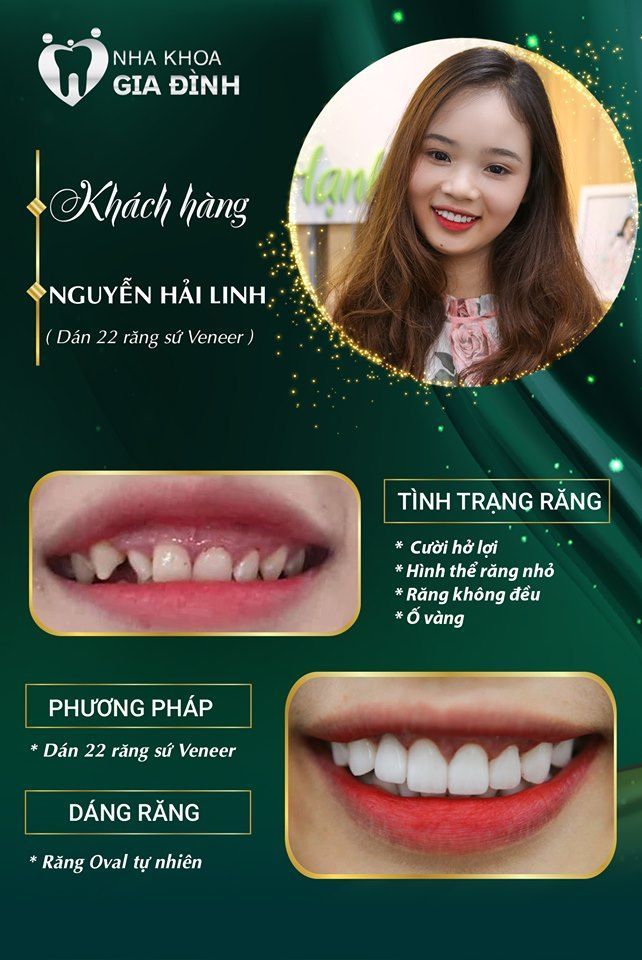 Tuy còn rất trẻ nhưng Hải Linh đã ý thức được vấn đề về sức khỏe răng miệng.